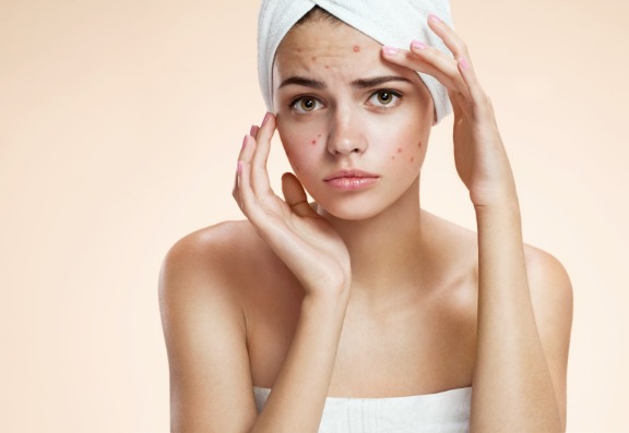 Can a popular acne treatment cause serious bowel injuries