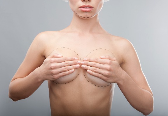 The risks of having Breast augmentation