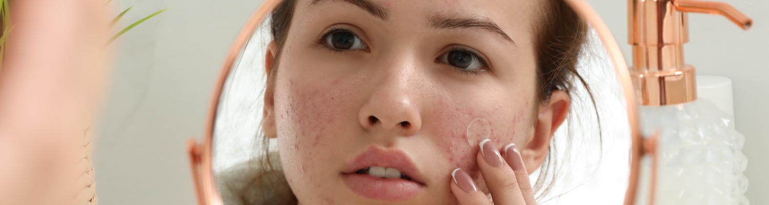 Do You Suffer From Skin Laxity or Acne Scarring? 