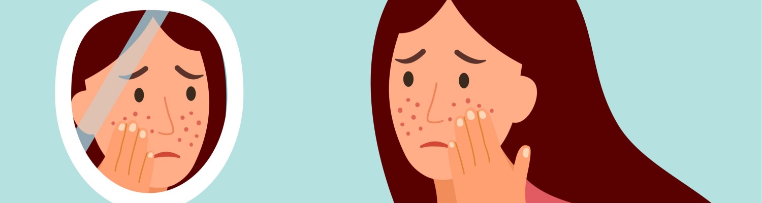 The Shocking Link Between Depression and Roaccutane