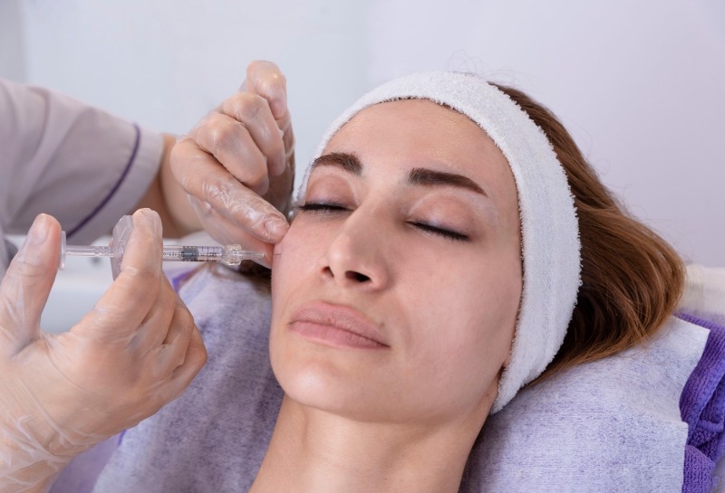 Everything You Need to Know About Collagen Stimulating Filler