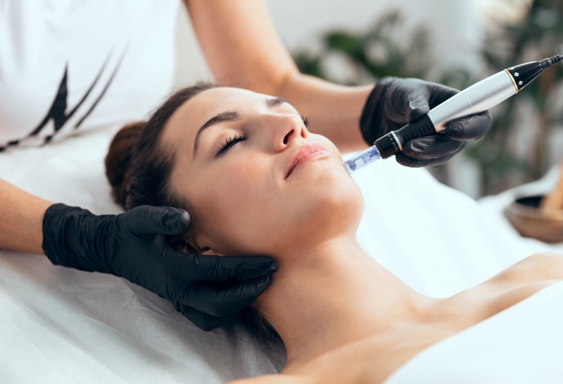Is DermaFNS Pen Microneedling The Solution to Dull Skin?