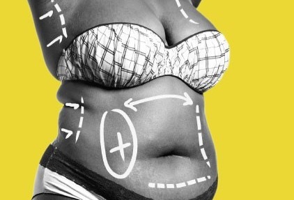 Everything You Need to Know About Fat Transfer Procedures