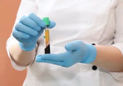 How Does PRP Work Image