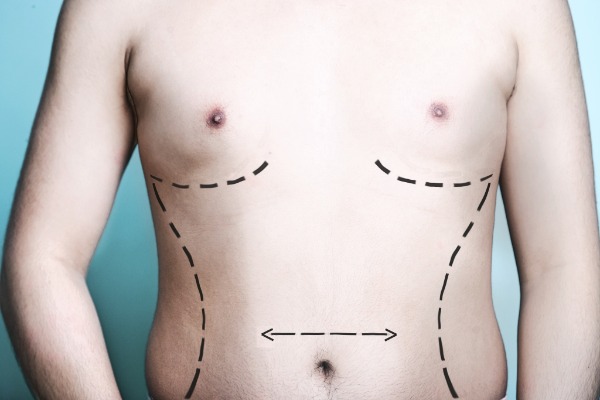 Implants (Body) Information Image