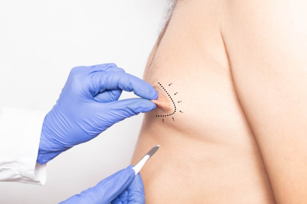 Breast Nipple Surgery Information Image