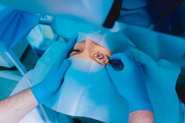 LASEK (Laser-Assisted Sub-Epithelial Keratectomy) Laser Eye Surgery Image