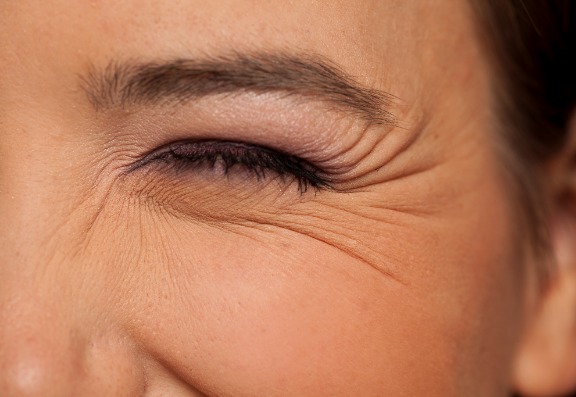 How do wrinkles develop with age?