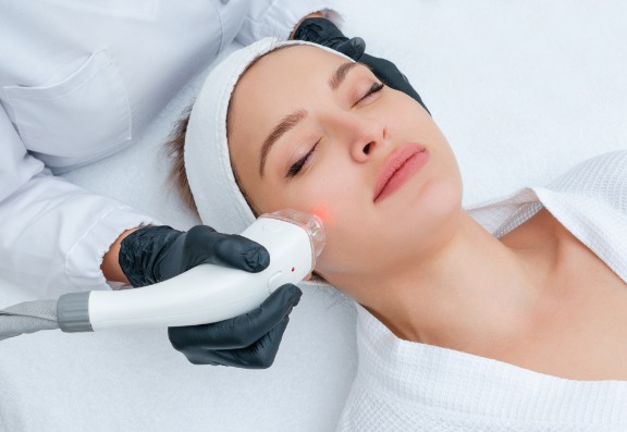 The Best Laser Treatments for Acne Scars