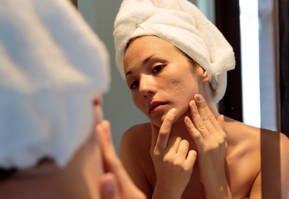 What Causes Acne Scars?