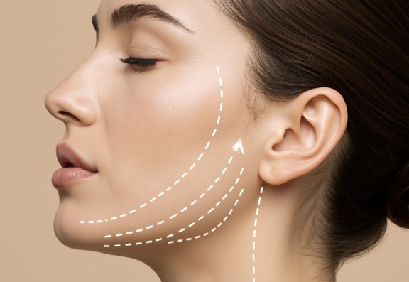 What weakens elastin?