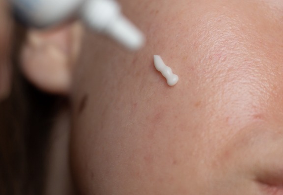 Effective Hyperpigmentation Treatments: