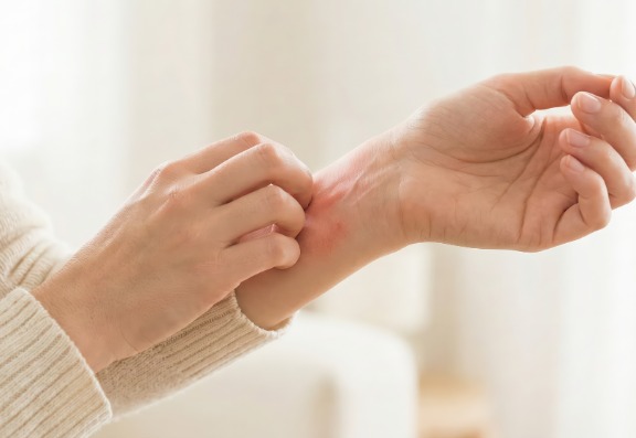 What is Sensitive Skin? What is Sensitive Skin?