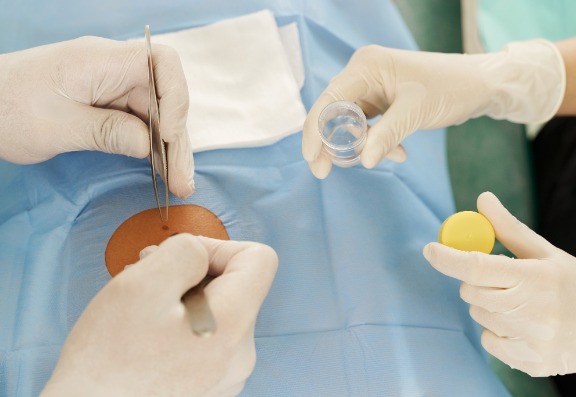 rebuilding confidence after skin cancer treatment?