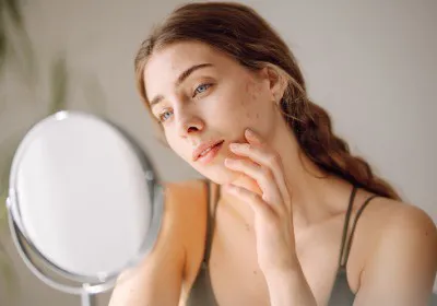 Acne begins as inflammation Acne begins as inflammation