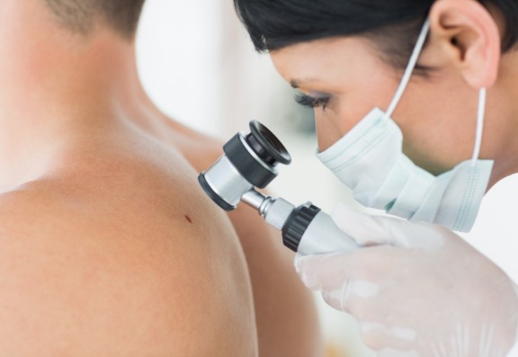 Things to look for to recognise skin cancer early