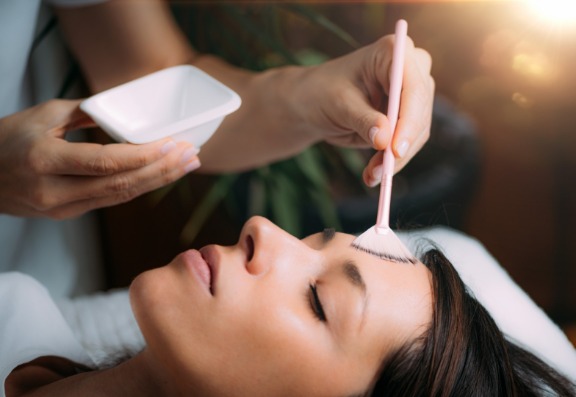 What is a chemical peel