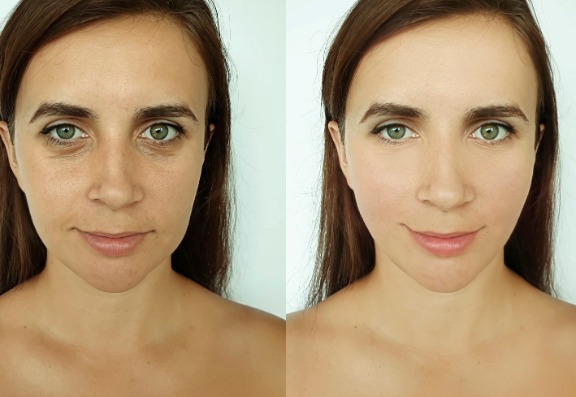 How to reduce Lines and wrinkles around the eyes
