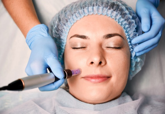 What Microneedling Collagen Induction Therapy