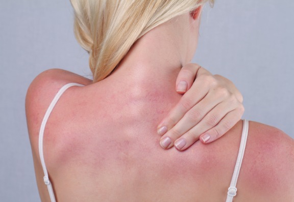 How Does the Sun Cause Damage?