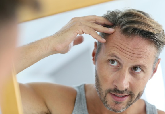 What should you do if you think creatine might be causing hair loss? 