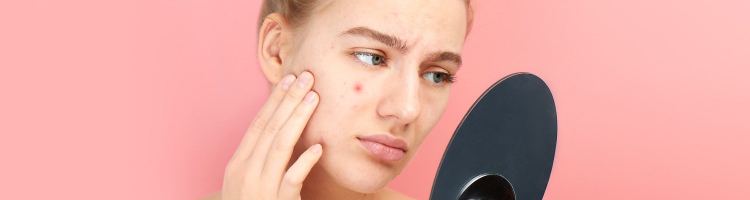 Acne Awareness Month: The Best Adult Acne Treatments