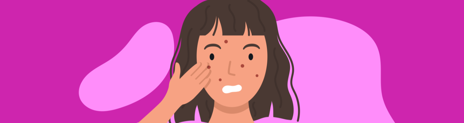 Acne Myths You Need to Ignore Immediately