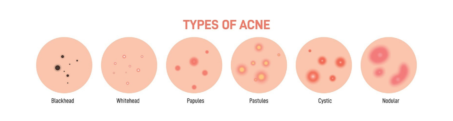 Can Ethnicity and Where You Live Affect the Condition of Your Skin?