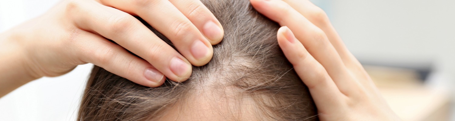 Can Hair Loss Be Reversed?