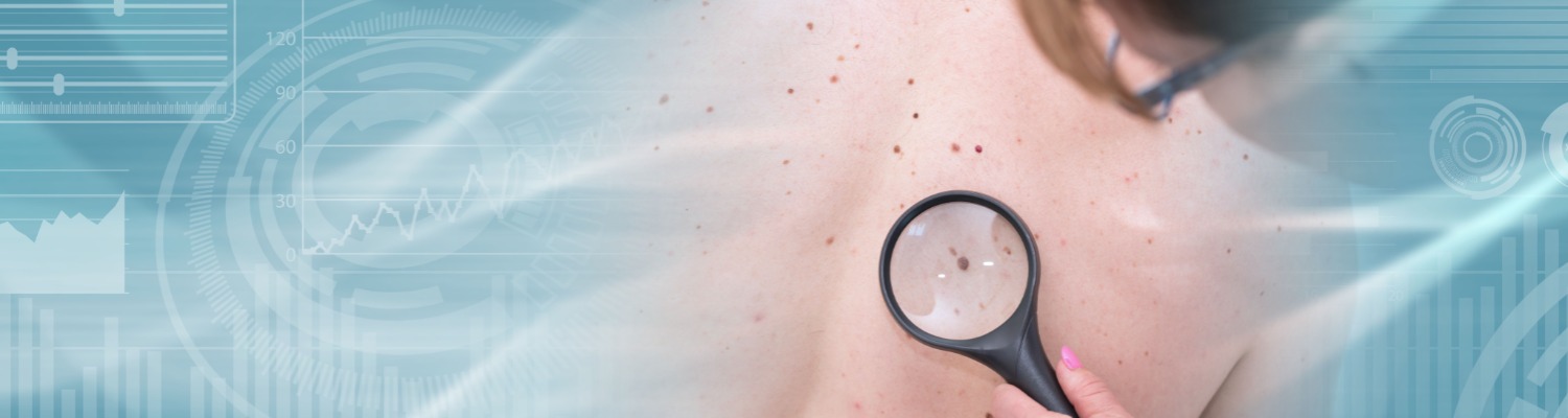 How to Identify the 5 Different Types of Melanoma