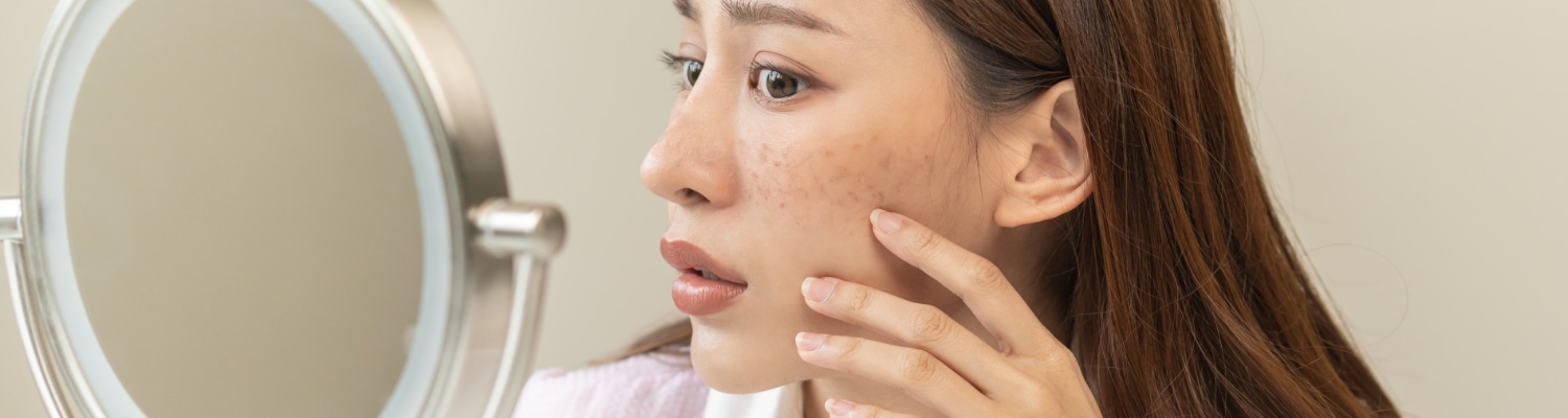 How HydraFacial Can Help Repair Sun-Damaged Skin