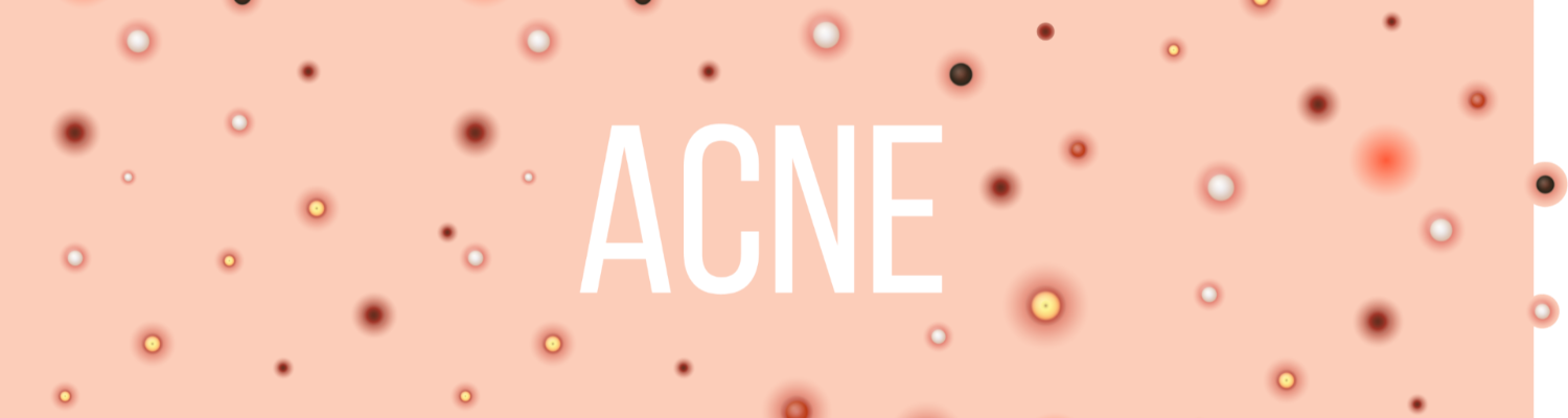 Is This a Total Game-Changer for Acne Treatment?