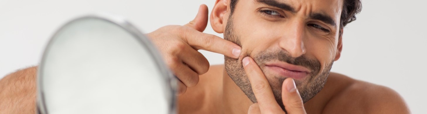 Why Do Men Get Acne?