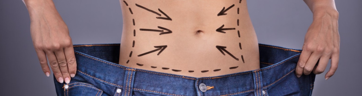 Why Liposuction Is Not a Treatment for Obesity