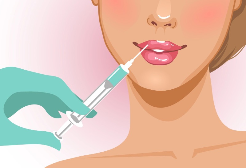 3 Ways Lip Fillers Can Improve Your Smile