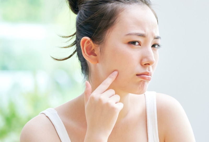 Can Ethnicity and Where You Live Affect the Condition of Your Skin?