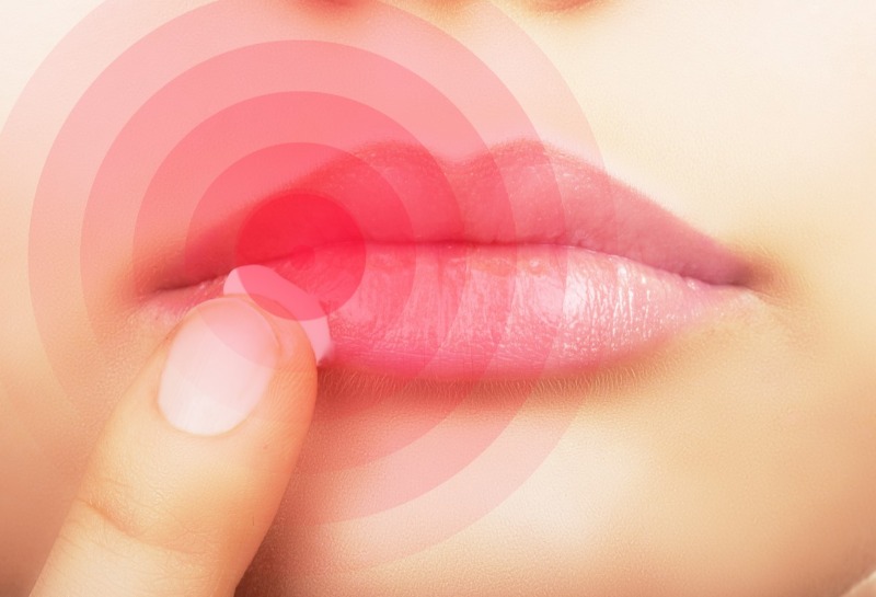 Does Botox Work to Treat Cold Sores?