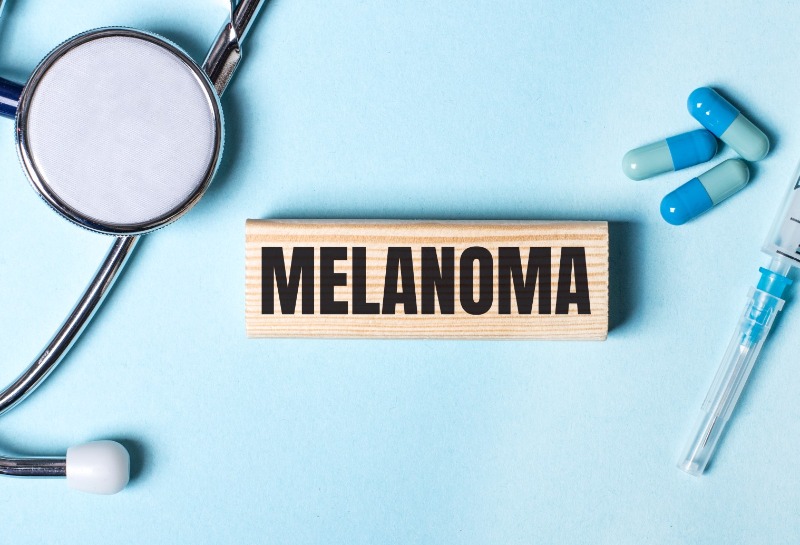 How to Identify the 5 Different Types of Melanoma