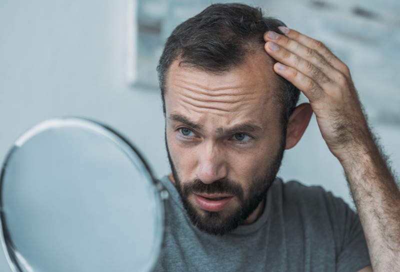 Help I’m Balding! Men’s Hair Loss Treatments and Solutions