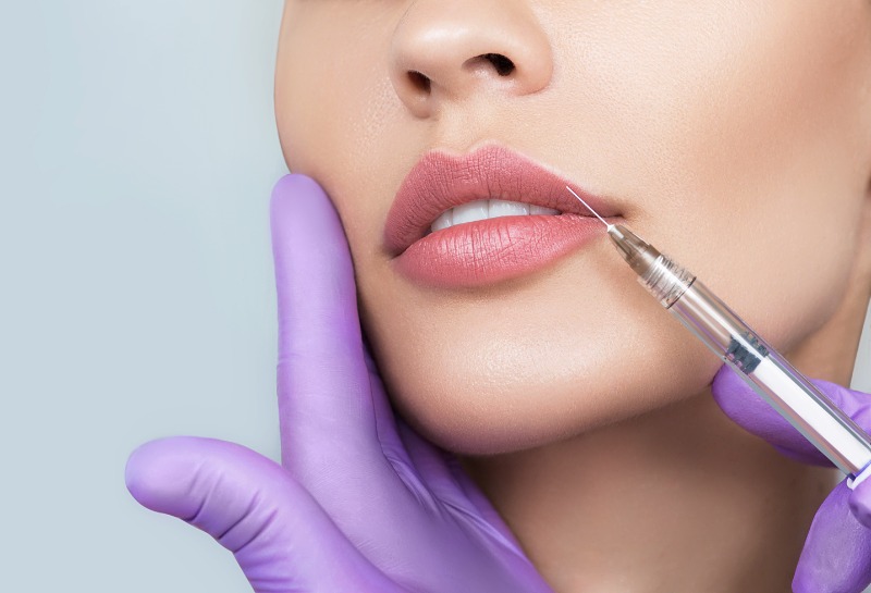 Is the Filler Trend Dying out?