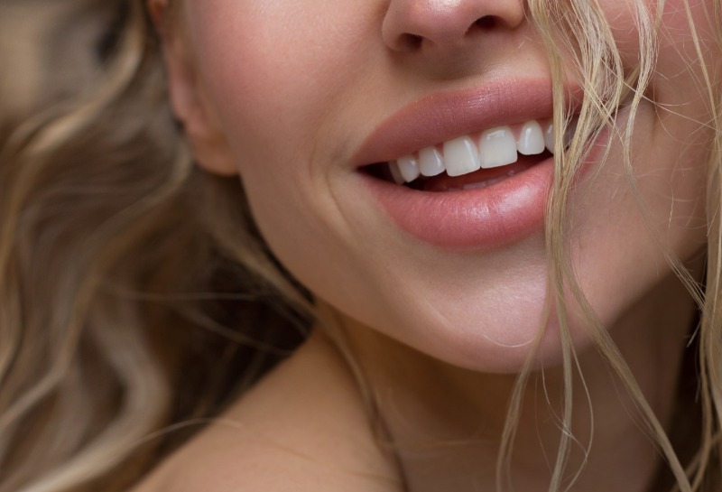 Trends in Natural Lip Enhancement With Restylane