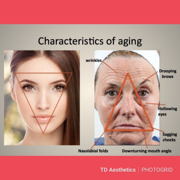 Characteristics of ageing Photo