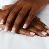 Hand Rejuvenation Thumbnail