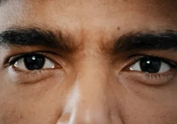 Heavy Brow clinics