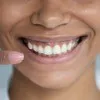 Teeth - Cosmetic Dentistry  Thumbnail