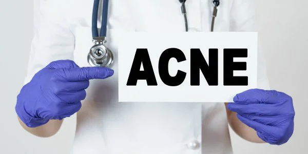 Professional Advice For Acne