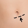 Belly Button Shape