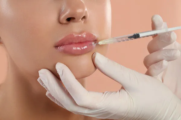Lip Filler Gone Wrong