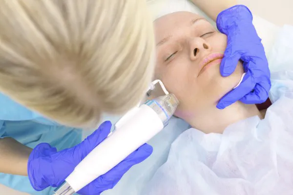 Under the Microneedling Scope
