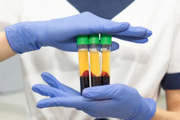 A Milestone For PRP Safety